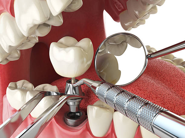 Best Broken or Chipped Tooth Repair in Paradise Hills, NM